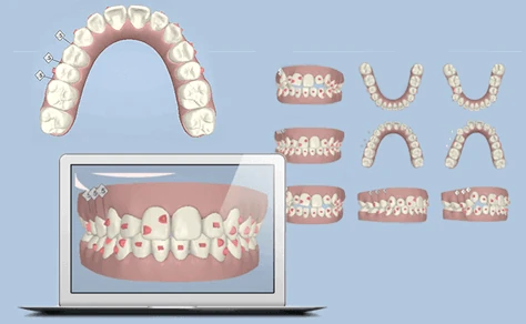 3Dシミュレーション