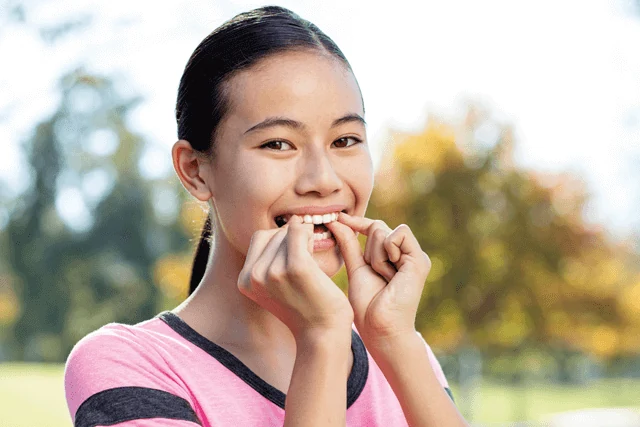 マウスピース矯正「アライナー」を着ける女性の写真