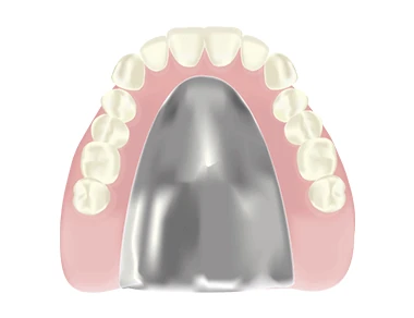 金属床義歯イメージ